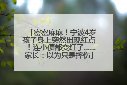 密密麻麻！宁波4岁孩子身上突然出现红点！连小便都变红了……家长：以为只是摔伤